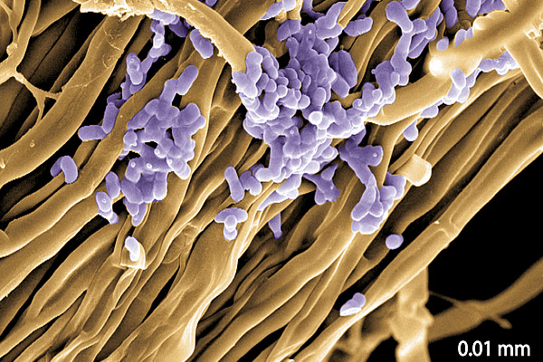 There is a colony of bacteria in violett, which are round and adhere to orange long structures. The latter are fungal hyphae. There is a scale that says "0.01 millimeters".