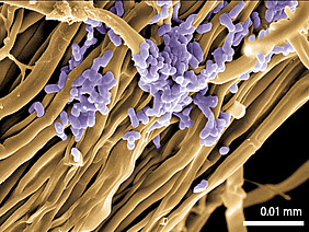 There is a colony of bacteria in violett, which are round and adhere to orange long structures. The latter are fungal hyphae. There is a scale that says "0.01 millimeters".